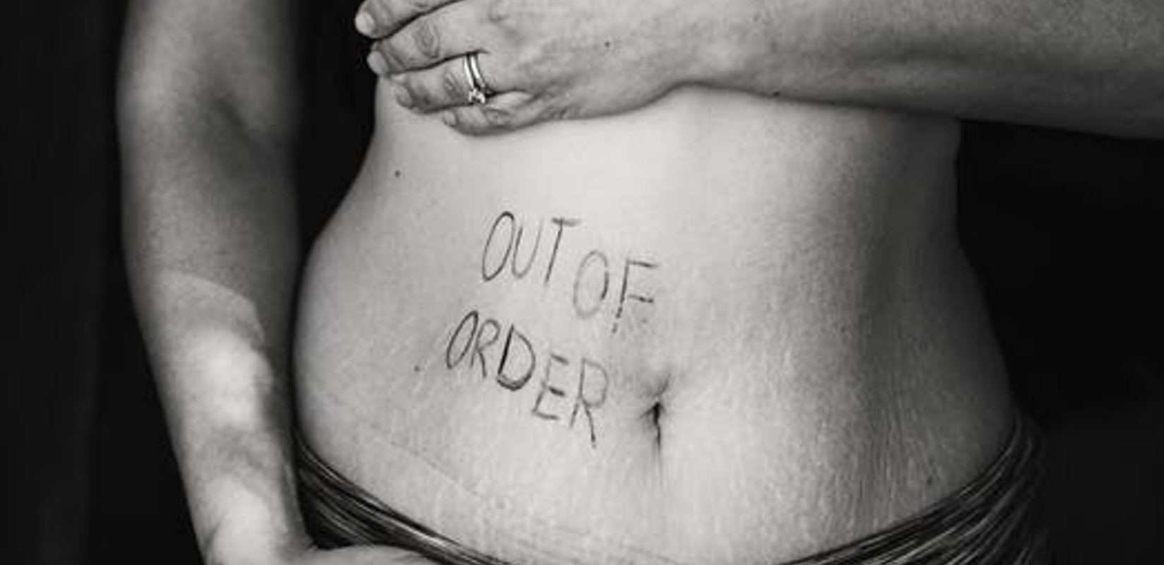IBS symptoms, treatments and causes